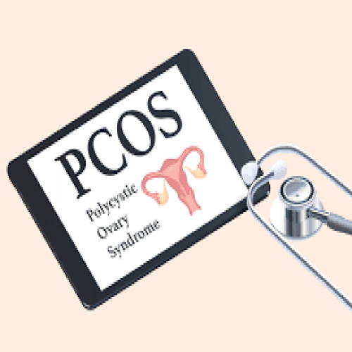 سندروم تخمدان پلی کیستیک (PCOS)